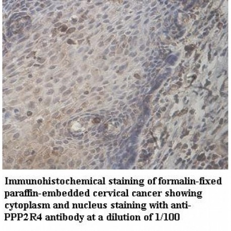 PPP2R4 Antibody