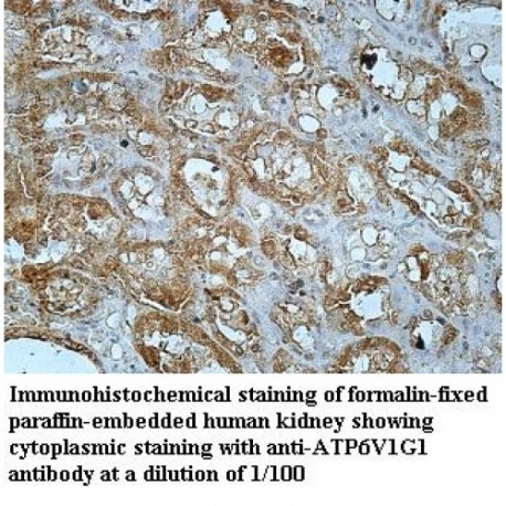 ATP6V1G1 Antibody