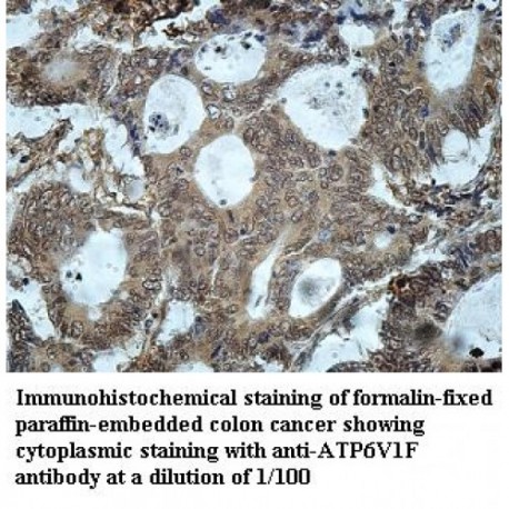 ATP6V1F Antibody