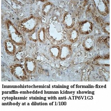 ATP6V1G3 Antibody