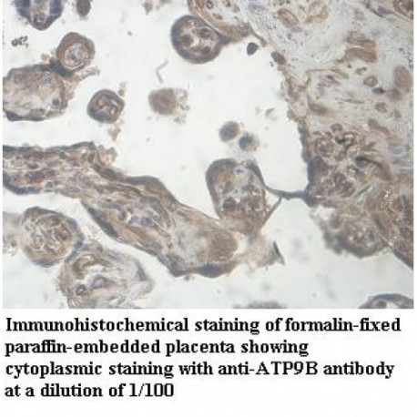 ATP9B Antibody