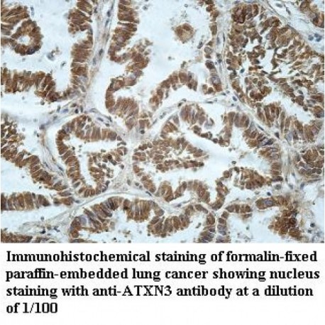 ATXN3 Antibody