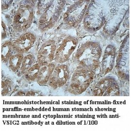 VSIG2 Antibody