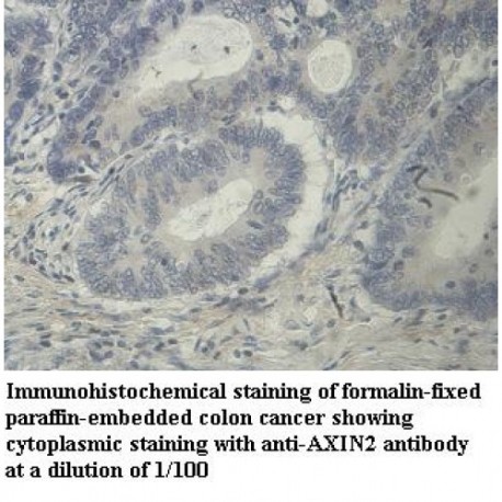 AXIN2 Antibody