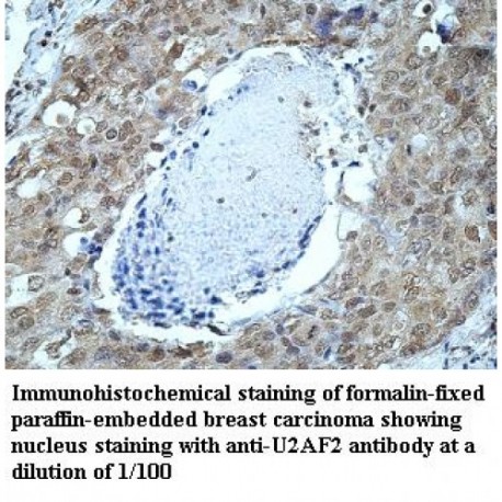 U2AF2 Antibody