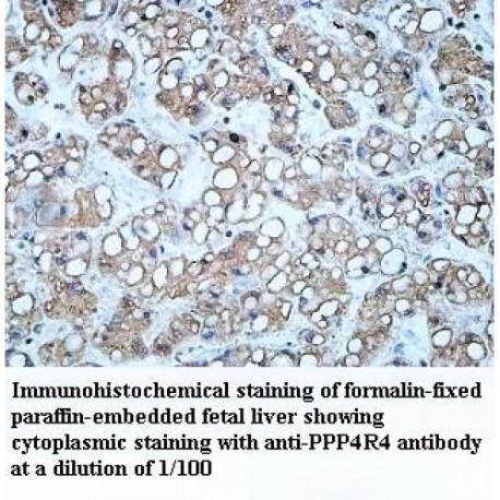 PPP4R4 Antibody