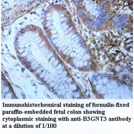 B3GNT3 Antibody