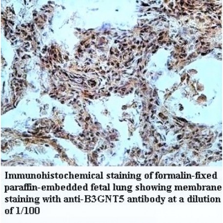 B3GNT5 Antibody