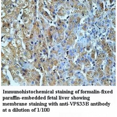 VPS33B Antibody