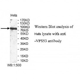 VPS53 Antibody