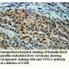 VSNL1 Antibody