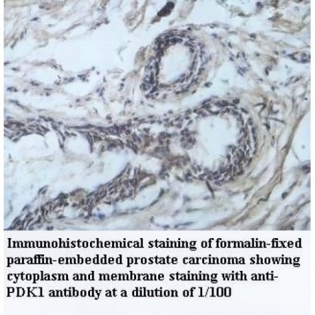 PDK1 Antibody