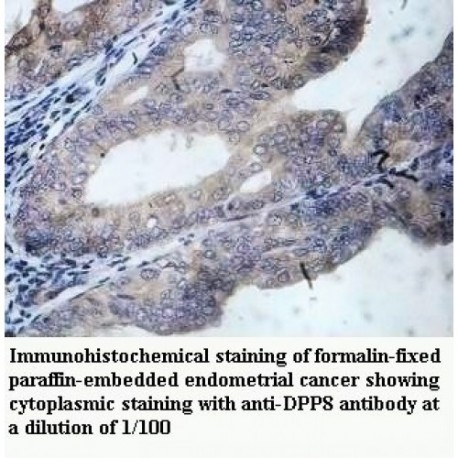 DPP8 Antibody