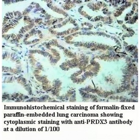 PRDX3 Antibody