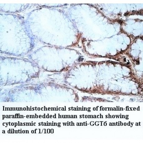 GGT6 Antibody