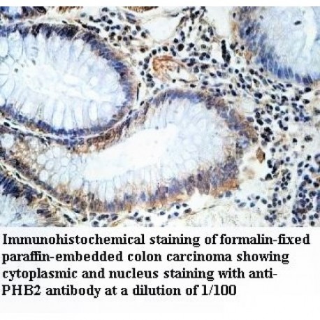 PHB2 Antibody