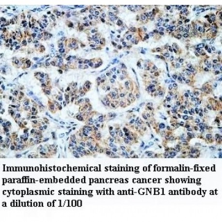 GNB1 Antibody