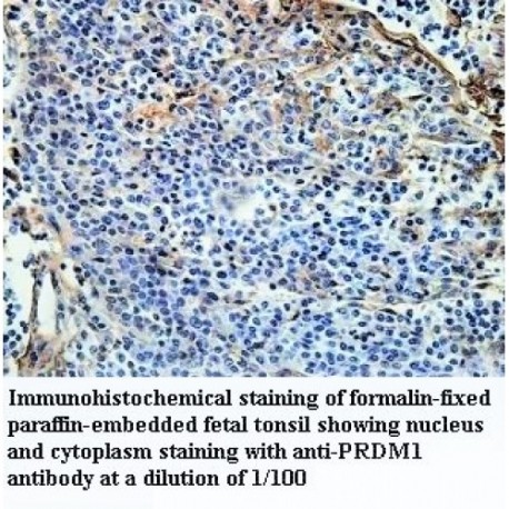 PRDM1 Antibody