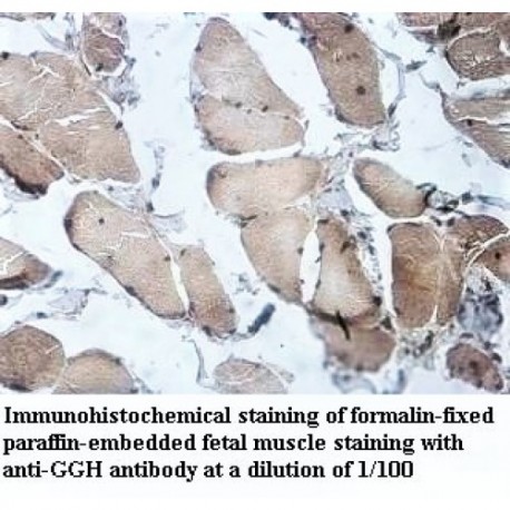 GGH Antibody