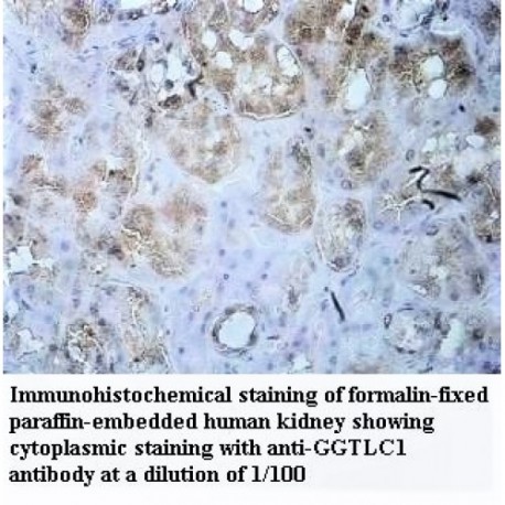 GGTLC1 Antibody