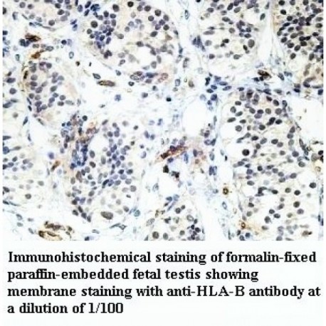 HLA-B Antibody