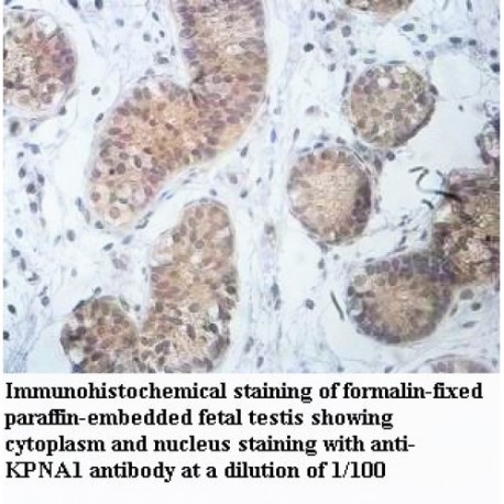 KPNA1 Antibody