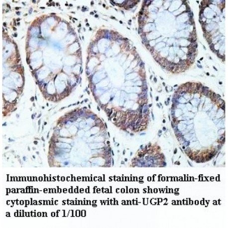 UGP2 Antibody