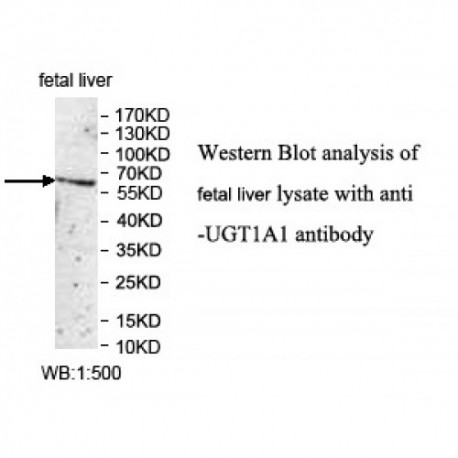 UGT1A1 Antibody