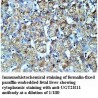 UGT2B11 Antibody