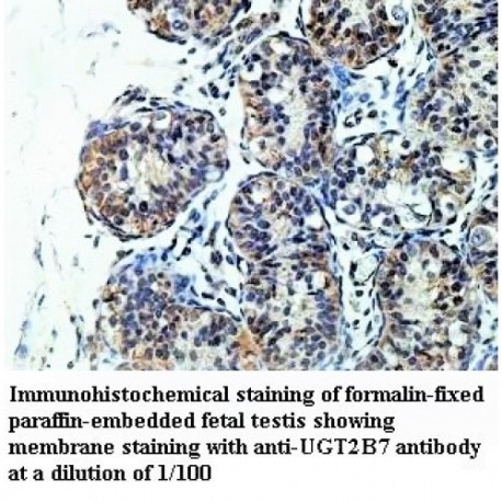 UGT2B7 Antibody