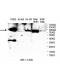 PRKCB Antibody