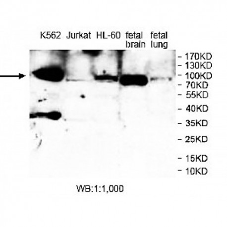 PRKCB Antibody