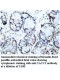 TACC1 Antibody