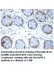 BAIAP2L1 Antibody