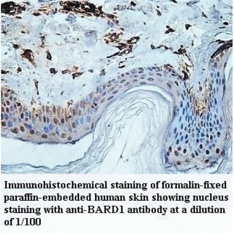 BARD1 Antibody