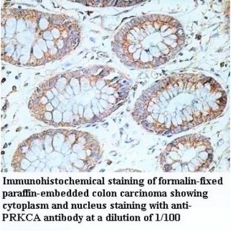 PRKCA Antibody