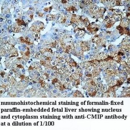 CMIP Antibody