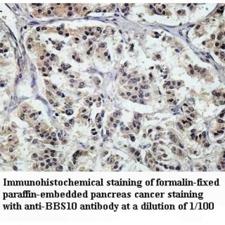 BBS10 Antibody