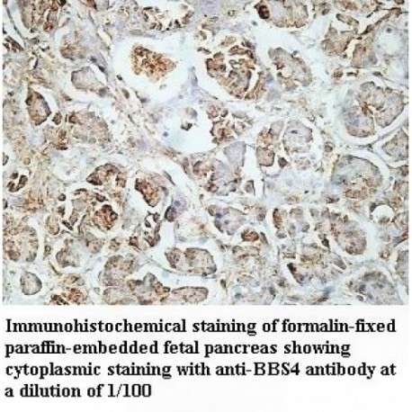 BBS4 Antibody