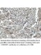 USHBP1 Antibody