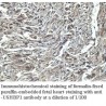 USHBP1 Antibody