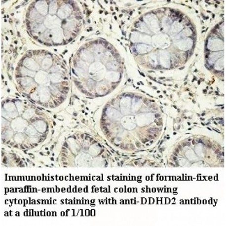 DDHD2 Antibody