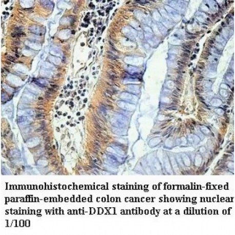 DDX1 Antibody