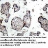 TBCE Antibody