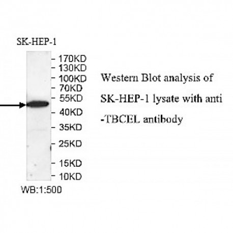 TBCEL Antibody