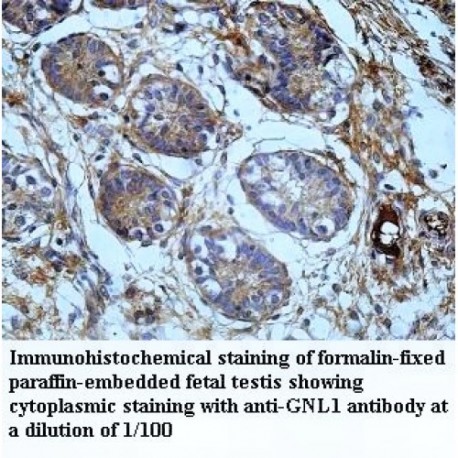 GNL1 Antibody