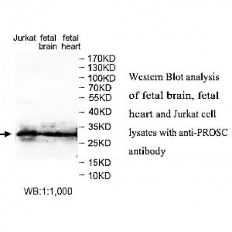 PROSC Antibody