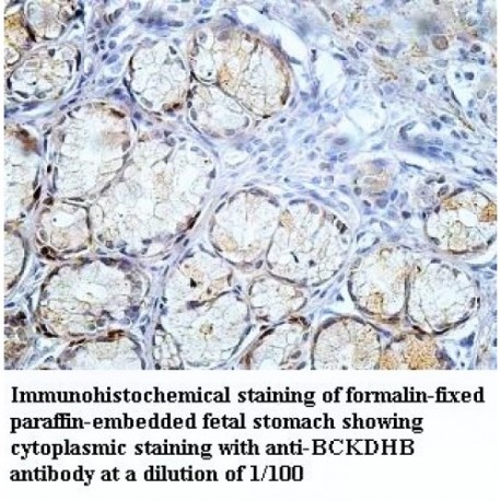 BCKDHB Antibody