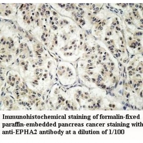 EPHA2 Antibody