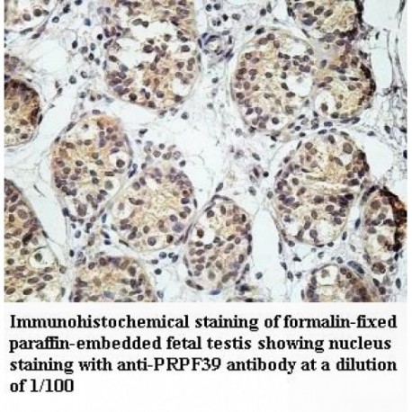 PRPF39Antibody